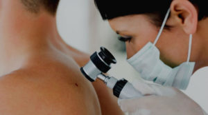 piel cancer consulta dermatológica